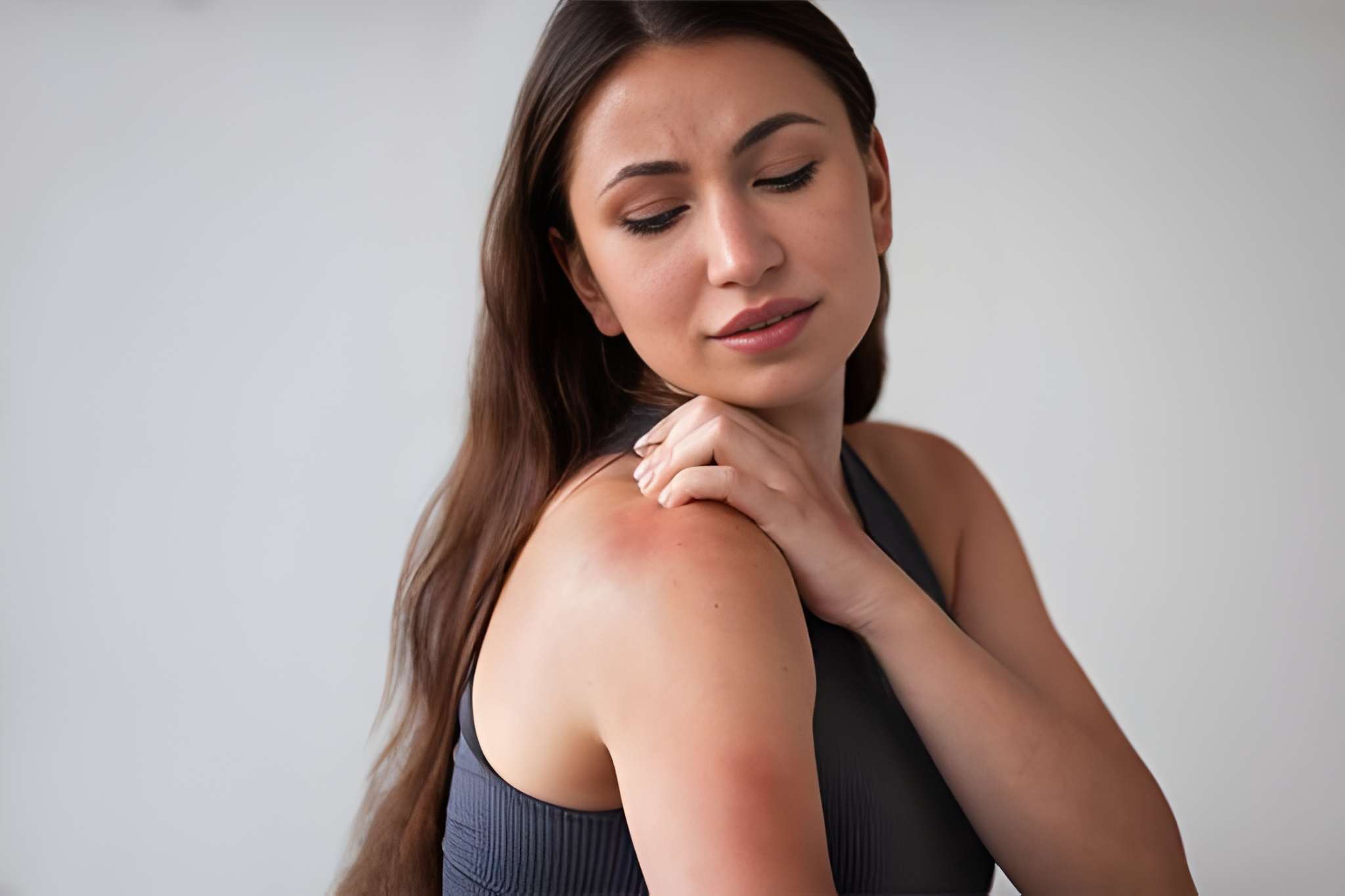 Dermatitsi